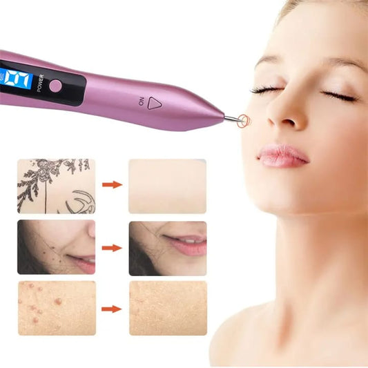 Rechargeable Small Mole & Spot Remover Pen – Portable Beauty Skin Care Device for Face & Body, Lightweight ABS Material